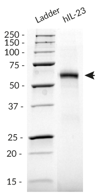 Detection by SDS-PAGE